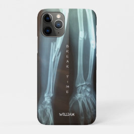Breuken Radius en Ulna Xray "Pauze tijd"    Case-Mate iPhone Case