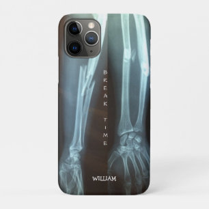Breuken Radius en Ulna Xray "Pauze tijd"    Case-Mate iPhone Case