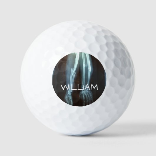 Breuken Radius en Ulna Xray "Pauze tijd" Golfballen (Voorkant)