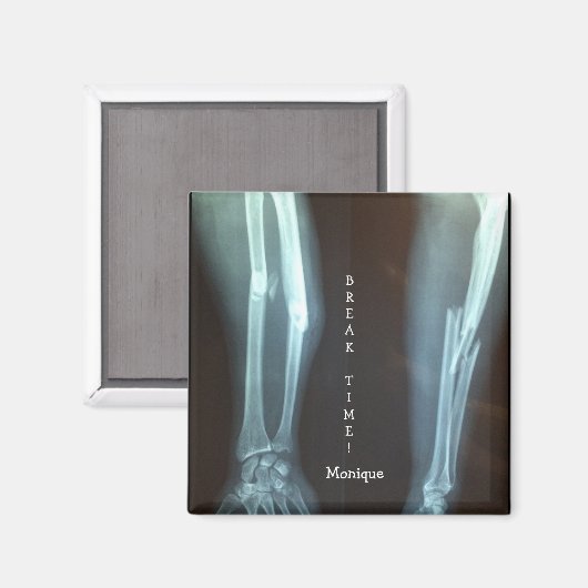 Breuken Radius en Ulna Xray "Pauze tijd" Magneet (Voorkant / Achterkant)