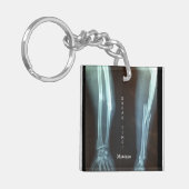 Breuken Radius en Ulna Xray "Pauze tijd"   Sleutelhanger (Voorkant Links)