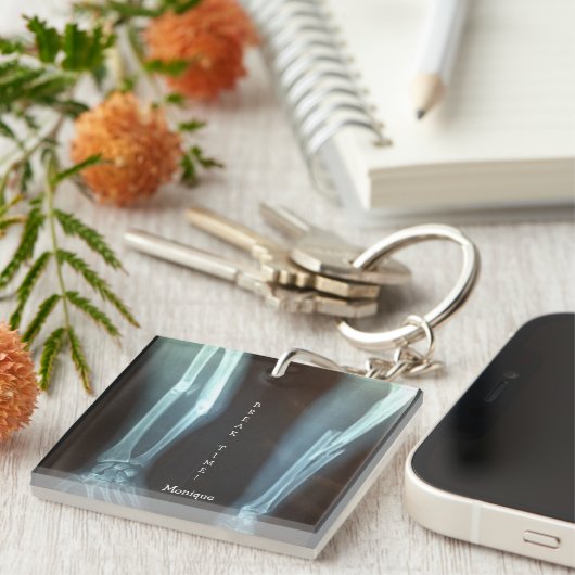 Breuken Radius en Ulna Xray "Pauze tijd"   Sleutelhanger (Voorkant Rechts)