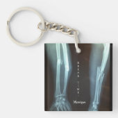Breuken Radius en Ulna Xray "Pauze tijd"   Sleutelhanger (Voorkant)
