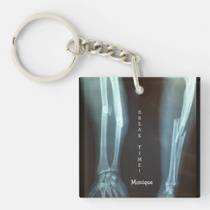 Breuken Radius en Ulna Xray "Pauze tijd" Sleutelhanger