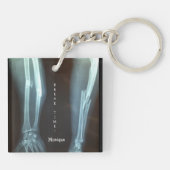 Breuken Radius en Ulna Xray "Pauze tijd"   Sleutelhanger (Achterkant)