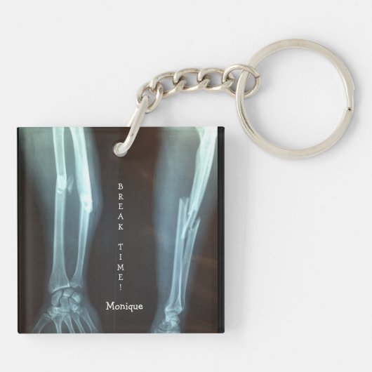 Breuken Radius en Ulna Xray "Pauze tijd"   Sleutelhanger (Achterkant)