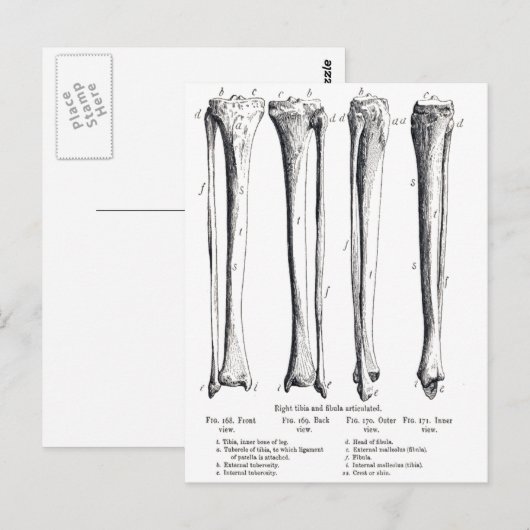 Briefkaart Fibula & Tibia (Voorkant / Achterkant)