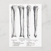 Briefkaart Fibula & Tibia (Voorkant)