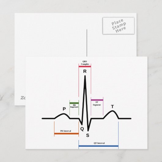 Briefkaart Sinus Rhythm (Voorkant / Achterkant)