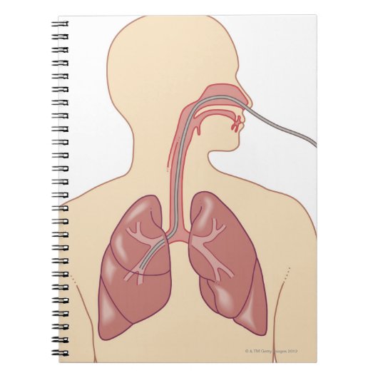 Bronchoscoop Notitieboek (Voorkant)