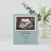 Budget Zwangerschap Aankondiging Ultrasound Foto (Staand voorkant)