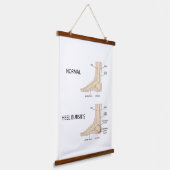 Bursitis calcanealis hangend wandkleed (Gebogen)