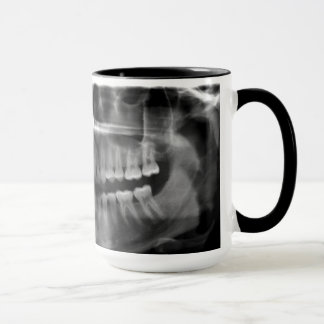 Caneca Radiografia Panoramica Mok