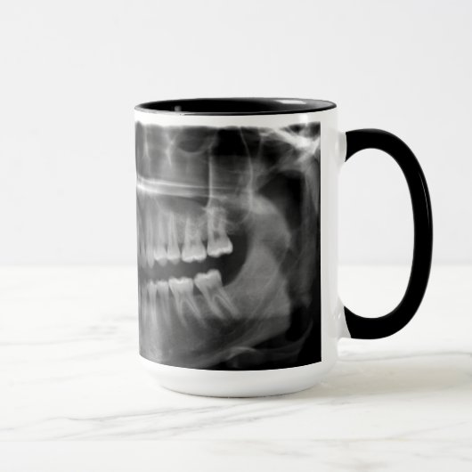 Caneca Radiografia Panoramica Mok (Rechts)