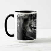 Caneca Radiografia Panoramica Mok (Links)