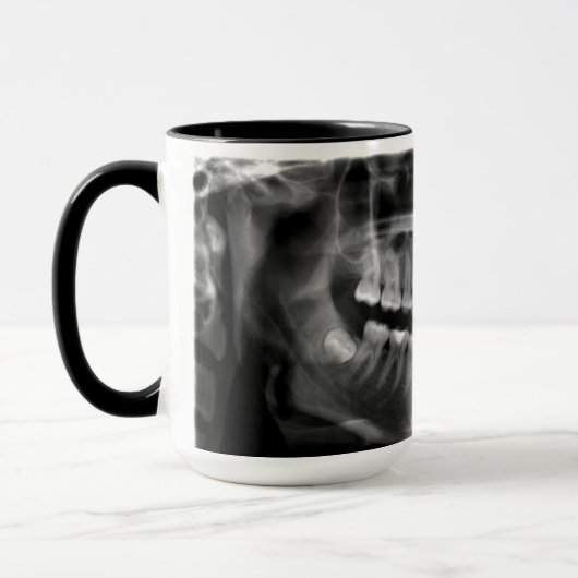 Caneca Radiografia Panoramica Mok (Links)