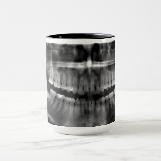 Caneca Radiografia Panoramica Mok (Midden)