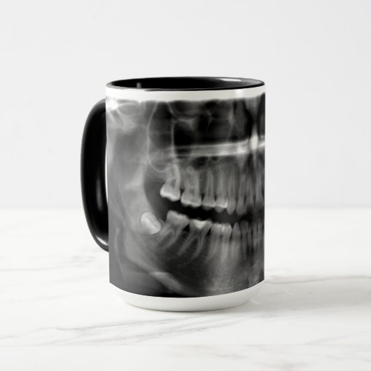 Caneca Radiografia Panoramica Mok (Voorkant links)