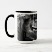 Caneca Radiografia Radiologia Mok (Links)