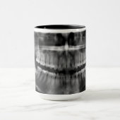 Caneca Radiografia Radiologia Mok (Midden)