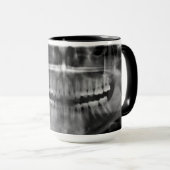 Caneca Radiografia Radiologia Mok (Voorkant rechts)