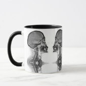 Caneca Radiologica Mok (Links)