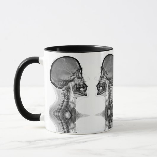 Caneca Radiologica Mok (Links)