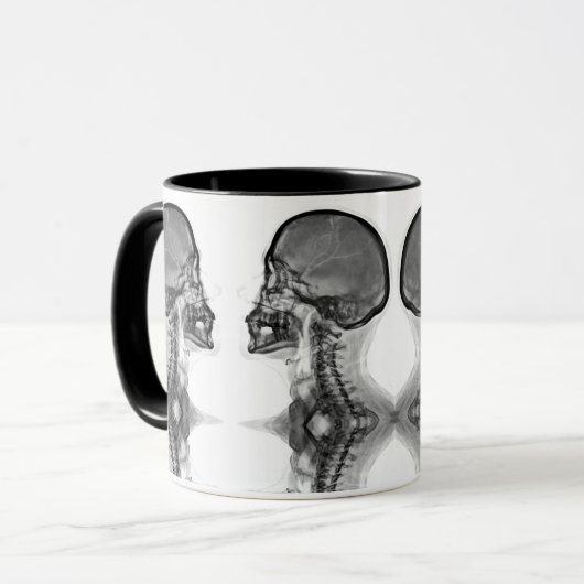 Caneca Radiologica Mok (Voorkant links)