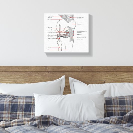 Canvas Anatomisch diagram rechtskniegewricht (Insitu (Slaapkamer))