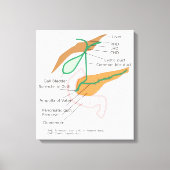 Canvas Galblaasdiagram Afdruk (Voorkant)