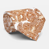 Carcinoom - Adenocarcinoom - Cytokeratin IHC Stropdas (Opgerold)