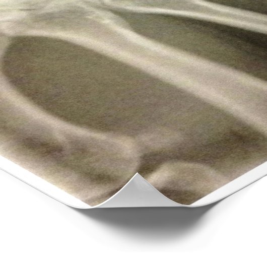 Carpals Xray Poster (Hoek)