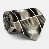 Carpals Xray Stropdas (Opgerold)