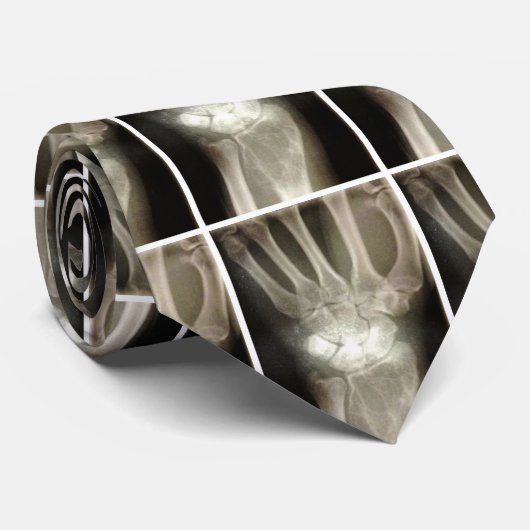 Carpals Xray Stropdas (Opgerold)