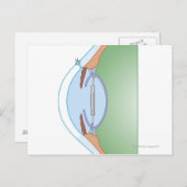 Cataractoperatie Briefkaart (Voorkant / Achterkant)