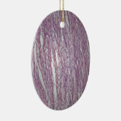 Cellen van humaan uterusweefsel met aanstootgevend keramisch ornament (Rechts)