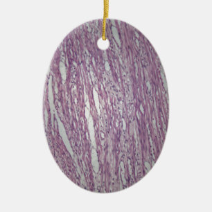 Cellen van humaan uterusweefsel met aanstootgevend keramisch ornament