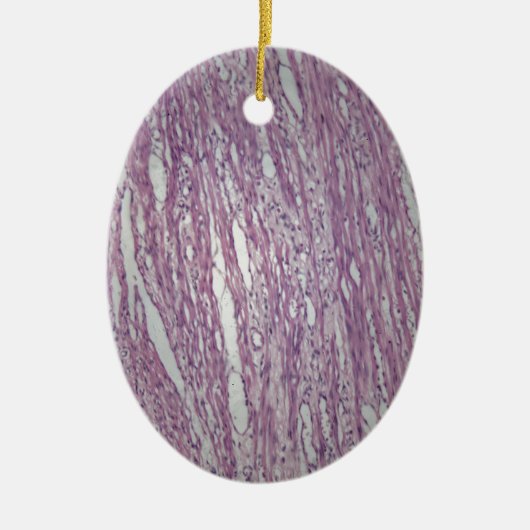 Cellen van humaan uterusweefsel met aanstootgevend keramisch ornament (Voorkant)