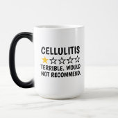 Cellulitis , Cellulitis Skin Disease Gifts, Funny  Magische Mok (Links)