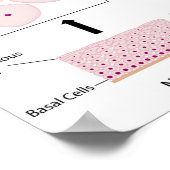 cervicale dysplasiestadia en pap-smear-test poster (Hoek)