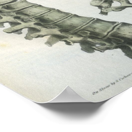 Cervicale en thoracale wervelkolom poster (Hoek)