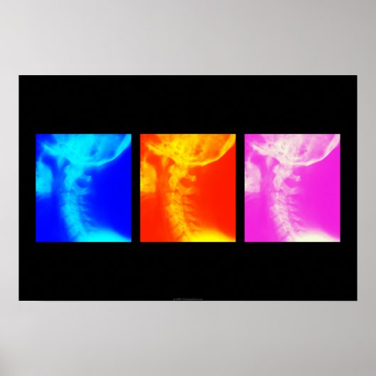 Cervicale röntgenfoto's poster 1 (Voorkant)