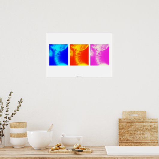 Cervicale röntgenfoto's poster 2 (Keuken)