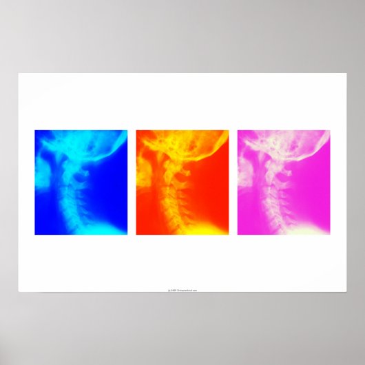 Cervicale röntgenfoto's poster 2 (Voorkant)