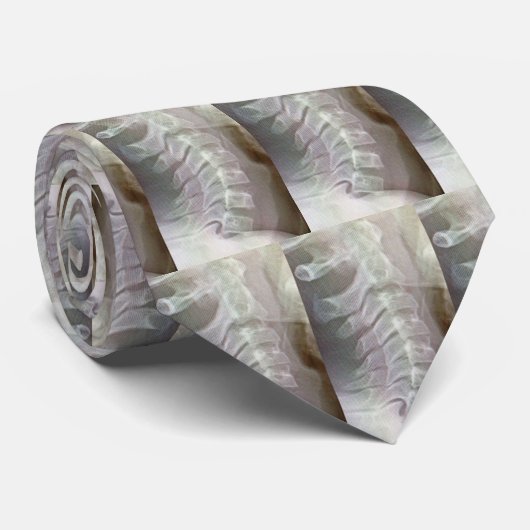 Cervicale Stropdas (Opgerold)