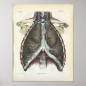 Chest Lung  Anatomy Print (Voorkant)