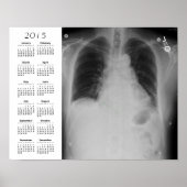 Chest X Ray agenda ~ Poster (Voorkant)