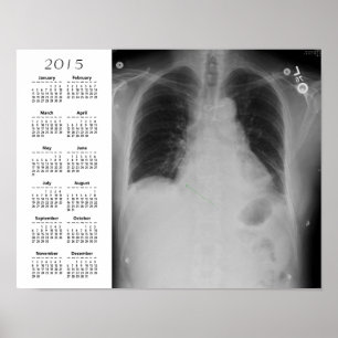Chest X Ray agenda ~ Poster
