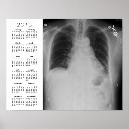 Chest X Ray agenda ~ Poster (Voorkant)
