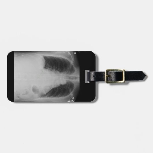 Chest X Ray ~ Bagagelabel (Voorkant horizontaal)